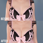 Jiggle Defender Silicone Adhesive Bra